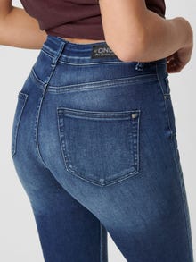 ONLY ONLBLUSH MID Waist ANKLE Jeans -Medium Blue Denim - 15159306