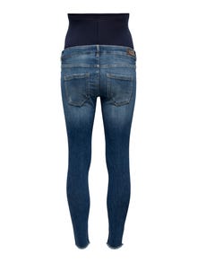 ONLY ONLBlush Mid ankle Skinny fit jeans -Dark Medium Blue Denim - 15277775