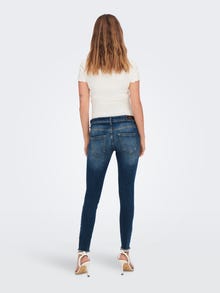 ONLY Skinny Fit Mittlere Taille Jeans -Dark Medium Blue Denim - 15277775