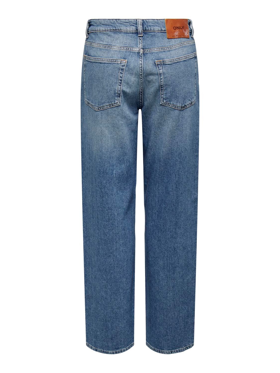 ONLY Dad Fit Jeans -Medium Blue Denim - 15311020